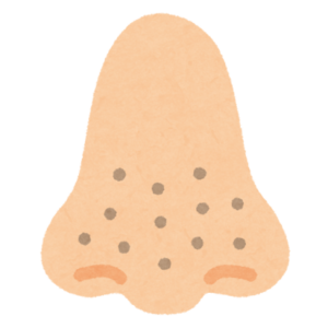 鼻の黒ずみ